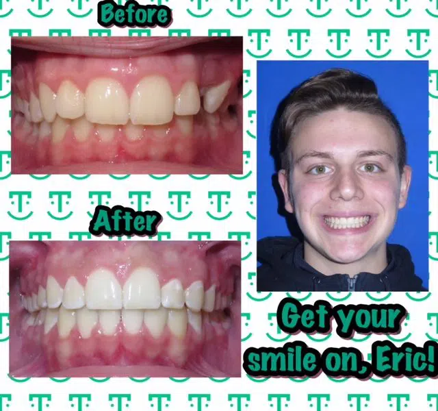 Finding Your Tru Smile!