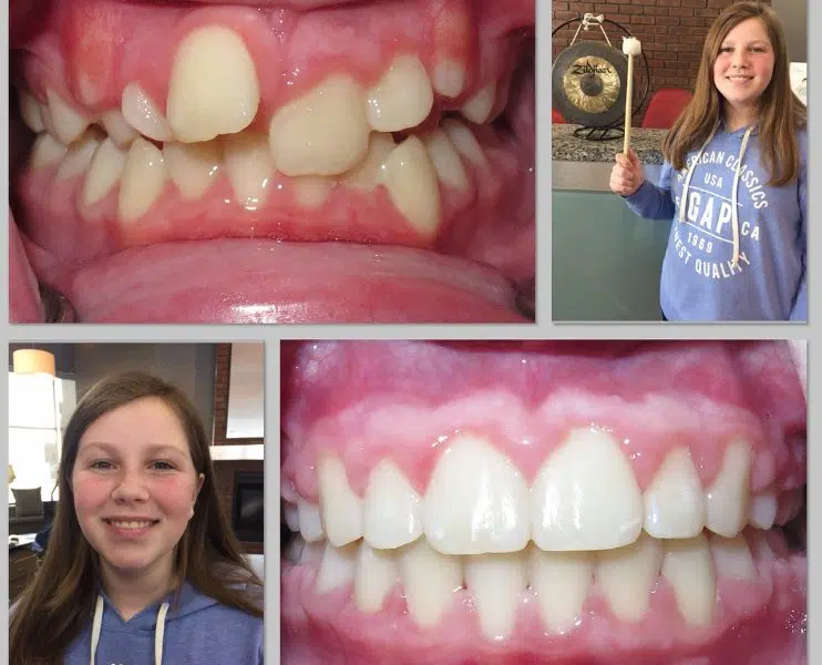 Incredible Smile Transformation!