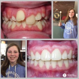 Incredible Smile Transformation!