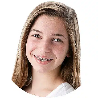 Life with Braces - Vaughan Orthodontist